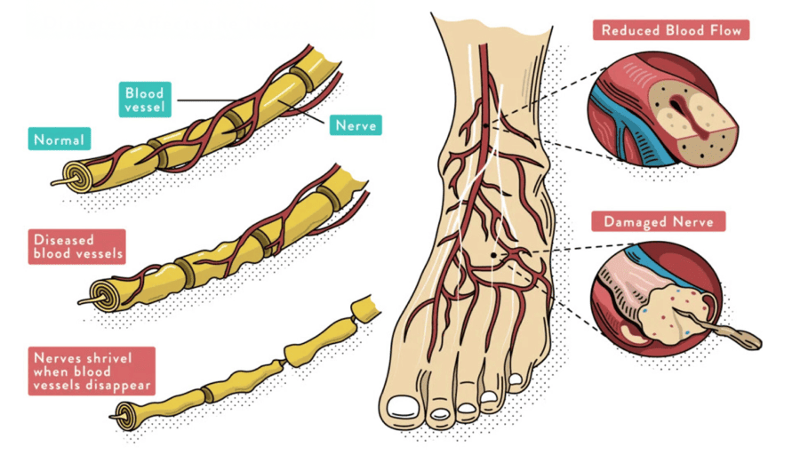 Grounded Footwear Barefoot shoes